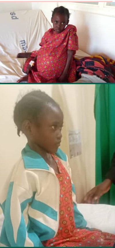 Mariam-Amos-before-and-After-Surgery