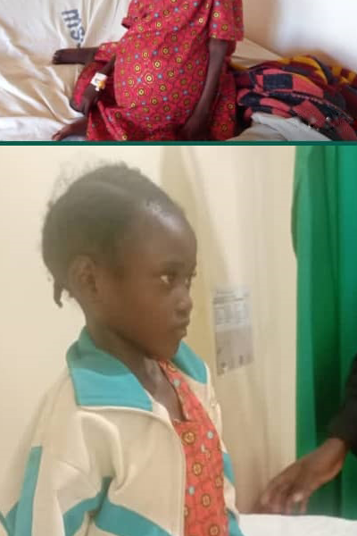 Mariam-Amos-before-and-After-Surgery